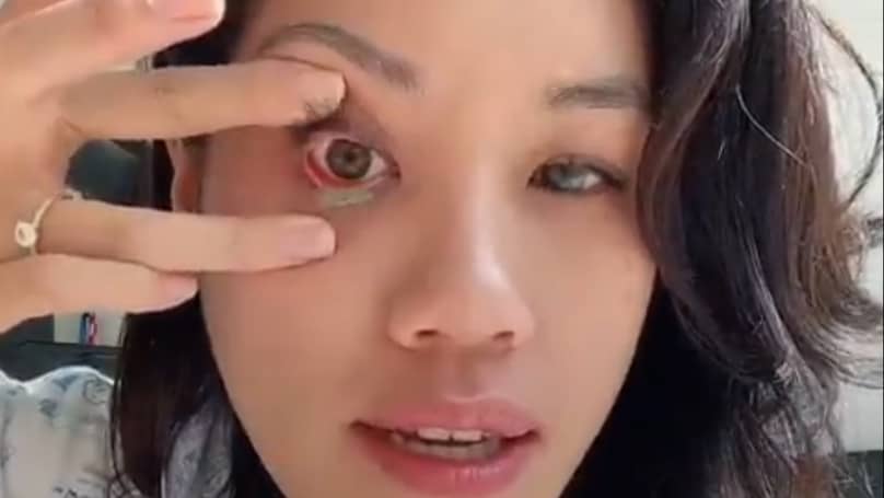TikTok User Shares Simple Trick To Remove Contact Lenses
