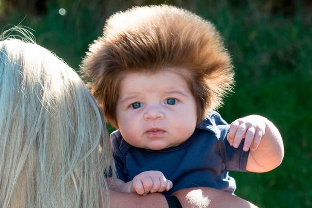 Baby Was Born With So Much Hair It Showed Up On Ultrasound Scan - LADbible
