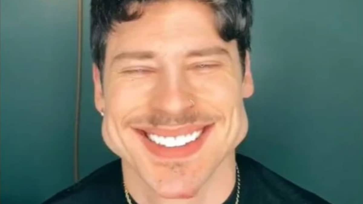 Featured image of post The Best 23 Guy With Big Chin Tiktok.
