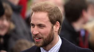 Prince William Embraces The Bald And Shaves Off Remaining Hair 
