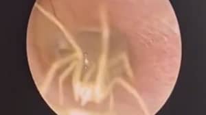 Doctor Finds Spider Scurrying Around Inside Woman's Ear Canal