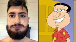Man Turns Into Real-Life Quagmire After Allergic Reaction To Beard Dye