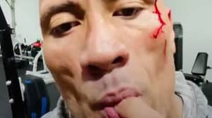 The Rock Tastes His Own Blood During Video Following Gym Accident 