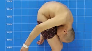 ​'Folded Man' Couldn’t Stand Up Straight For 28 Years