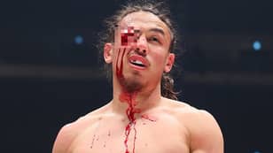 MMA-Fighter Yusuke Yachi Picks Up Gruesome Eye Injury In Mayweather Nasukawa Under-Card 