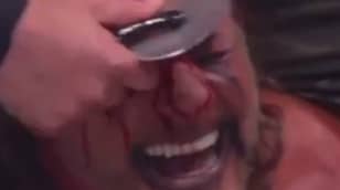 Chris Jericho Has Face Cut Open With Pizza Cutter In Wrestling Match