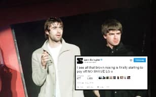Liam Gallagher Stops Calling Noel Gallagher A Potato To Call Him A 'Brown Nose'
