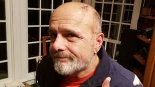 Bad Boys Actor Joe Pantoliano Recovering After Suffering 'Severe Head Injury'