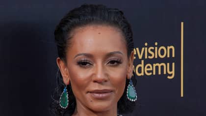 Mel B Hits Back After Being Accused Of Bleaching Her Skin