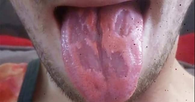The teacher's tongue had been 'eaten away'. Credit: Facebook/Dan Royals