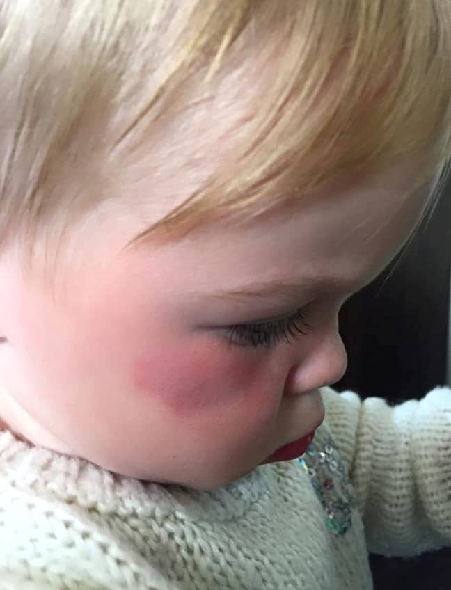 Mum Emily Vincent says a flock of seagulls attacked her little girl Jessie. Credit: SWNS 