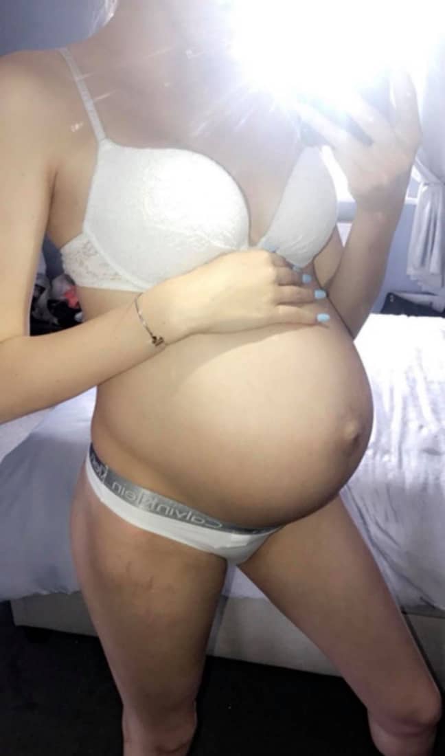 Saffron Heffer's baby bump after the midwife twisted her baby boy around. Credit: Kennedy News and Media