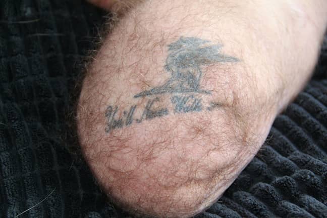 Andy says he was left with an 'unusual tattoo'. Credit: Andy Grant