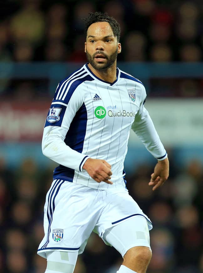 Joleon Lescott has a scar on his head from a car accident when he was a child. Credit: PA