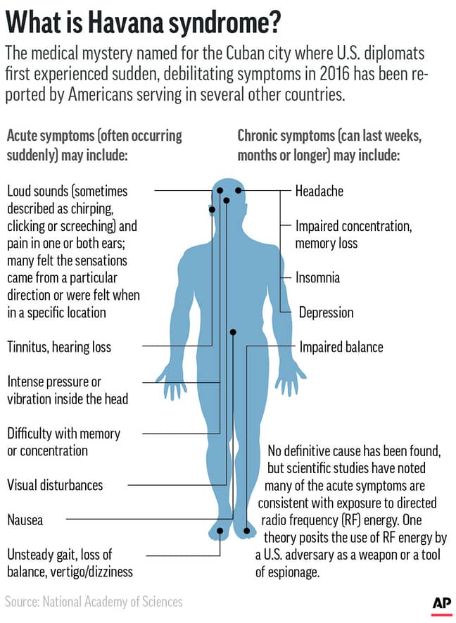 Havana syndrome symptoms. (Credit: PA)