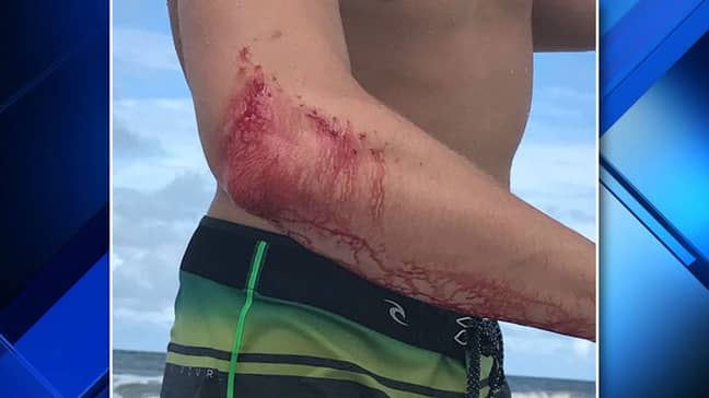 O'Rourke headed straight to the bar with his bloodied elbow. Credit: WJXT
