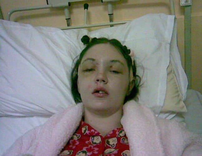 Gráinne Kealy underwent a gruelling 10-and-a-half hour surgery after the smash. Credit: Gráinne Kealy 