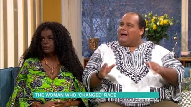 Martina's husband has also had injections to darken his skin. Credit: ITV / This Morning