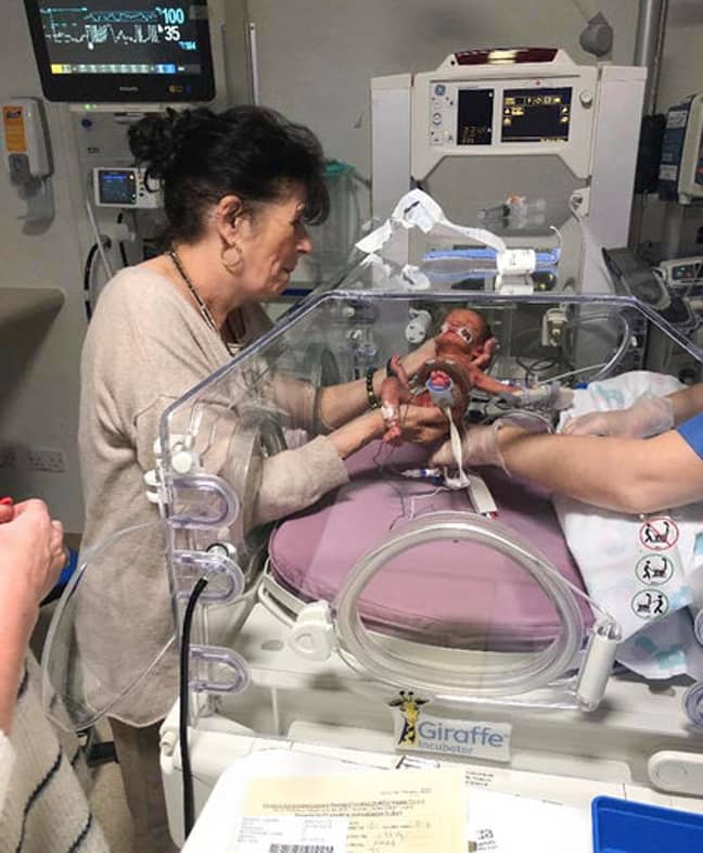 Both of the baby girls spent over 1,000 hours in NICU. Credit: Mercury Press 