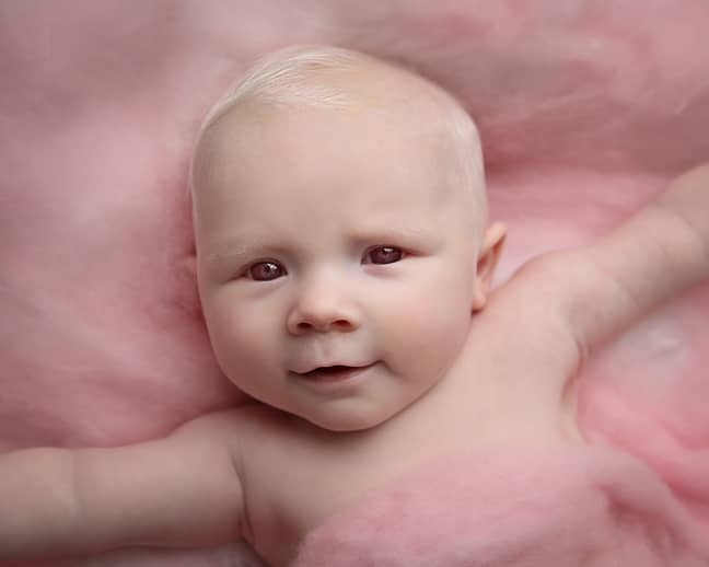 Baby Ava was born with Albinism. Credit: Hotspot Media / Evelyn and her Sweet Peas Photography