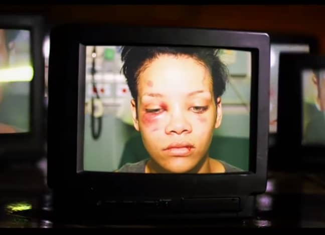 Rihanna after the assault  Credit: Chris Brown: Welcome to My Life/Riveting Entertainment