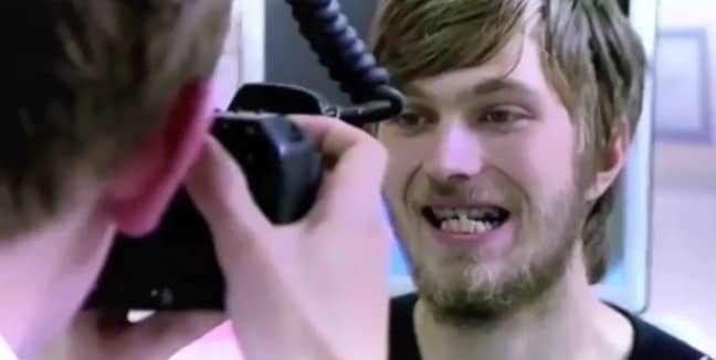 Мъж разкри как зъбите му се разпадат, след като не ги е мил 20 години