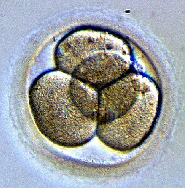 An embryo. Credit: Wikimedia Commons
