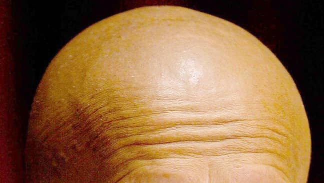 A bald man. Yeah, no shit. Credit: PA