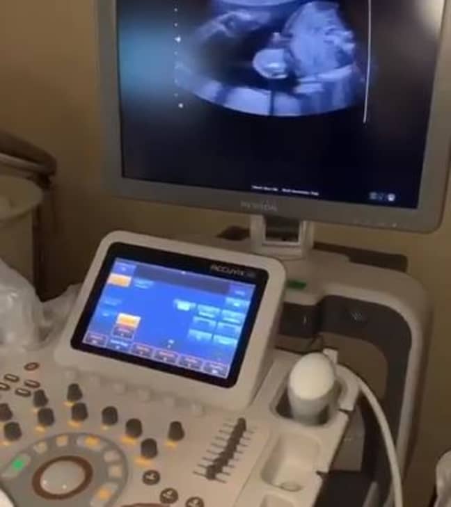 Part of the video showed the ultrasound scan. Credit: Instagram/@djkhaled