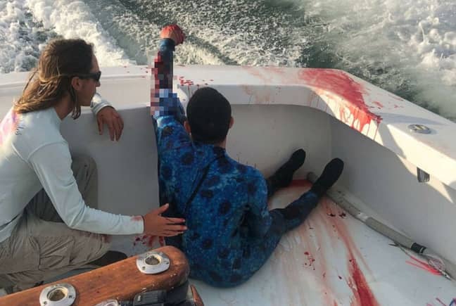 The 40-year-old man climbed onto a boat after being bitten by a shark. Credit: Hot Shot Charters/Miguel Martin