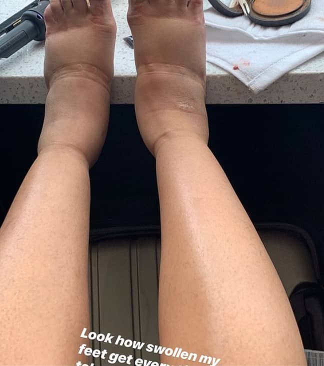 Cardi B revealed her swollen feet on Instagram. Credit: Instagram/Cardi B