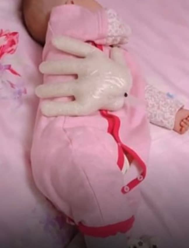 This picture shows a weighted glove on the baby. Credit: Weibo