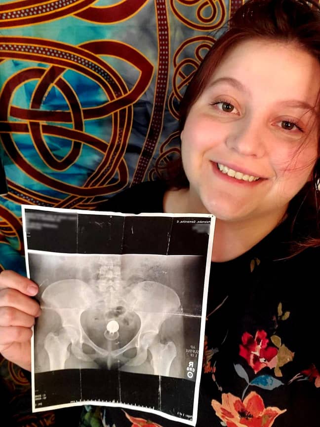 Samantha proudly posing with a print out of her x-ray... Credit: Kennedy News and Media