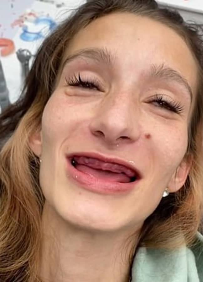 She had all of her teeth removed. Credit: TikTok/brittanynegler