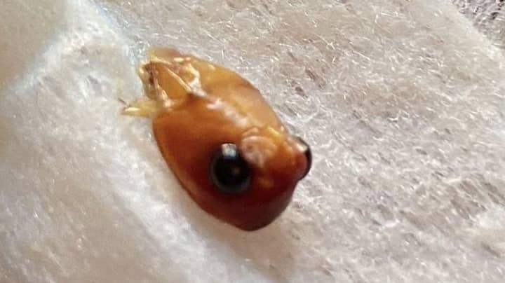 ​Mum Claims To Find ‘Creature’s Decapitated Head’ In Asda Baby Food