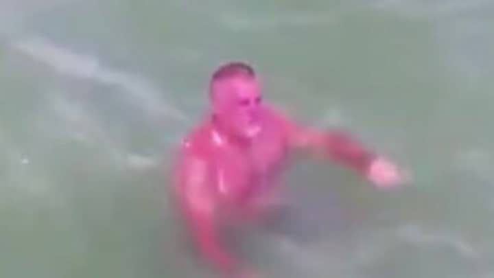 Man Suffers 'One Of The Worst' Sunburns While Swimming At Florida Beach
