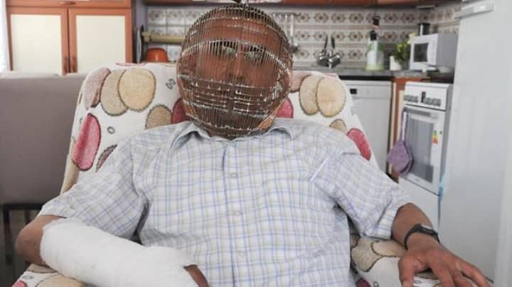 Man Locks His Head In Cage In Attempt To Stop Smoking