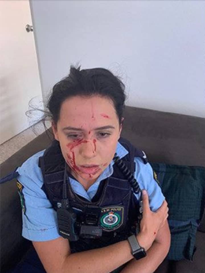 Shocking Images Of NSW Police Officer Battered On Patrol Goes Viral -  LADbible