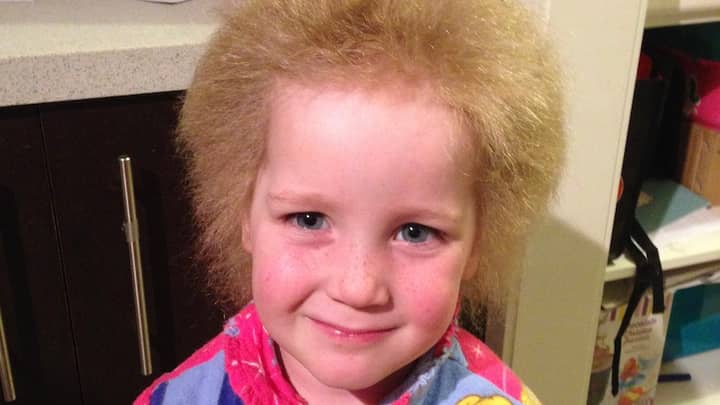 Youngster Has Embraced Fuzzy Hair That Makes Her Look Like Albert Einstein