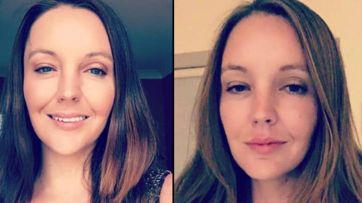 Woman Who Was Left Without A Forehead After Car Crash Warns Others Not To Rest Feet On Dashboard