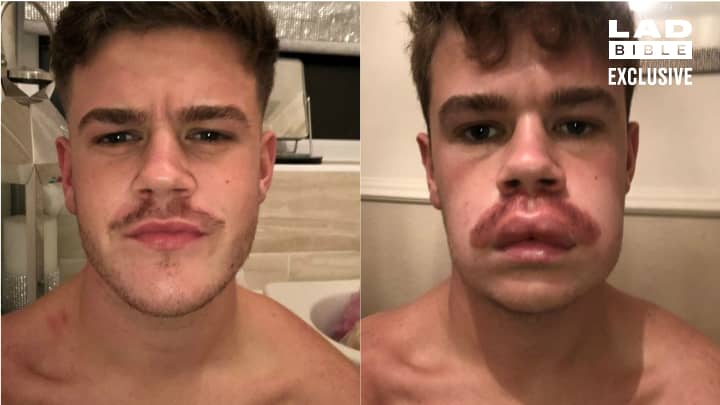 LAD Dyes His Moustache For Movember And It Really Doesn't Work