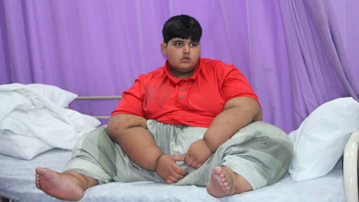 World's Heaviest Boy Weighs 31 Stone And Needs Life-Saving Surgery