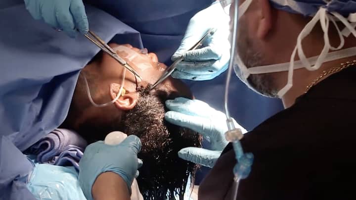 ​Footage Shows Successful Surgery Of Woman With Gorilla Glue In Hair