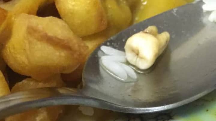 ​Couple Claim To Find Human ‘Tooth’ In Their Chinese Takeaway