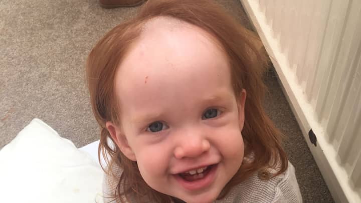 Little Girl Left 'Looking Like Pennywise' After Smothering Herself In Hair Removal Cream