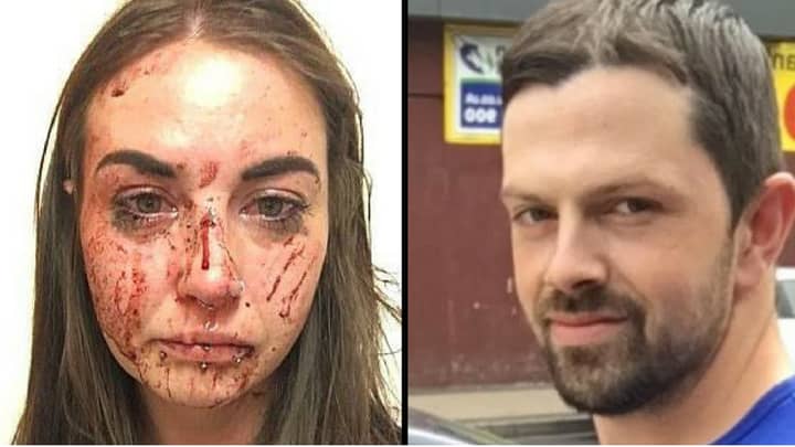 Woman Bravely Speaks Out After Brutal Beating From Her Boyfriend