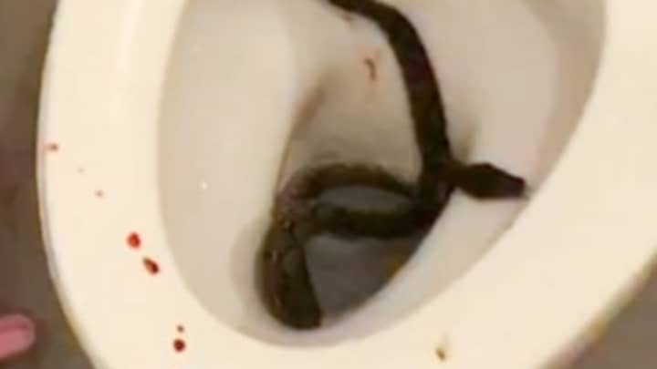 Huge Python Bit Teenager's Penis While He Was Sitting On The Loo 