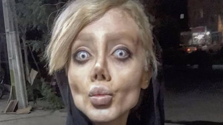 Young Woman Had Over 50 Operations To Look Like Angelina Jolie