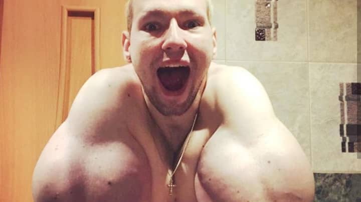 Russian 'Popeye' Says It's 'Sale Time' For Flesh Removed During Surgery