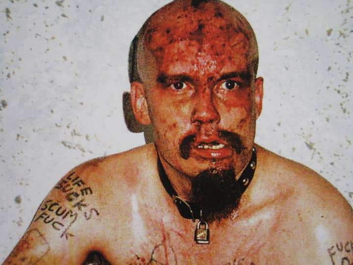 ​GG Allin: The Man Shat Himself On Stage And Smeared It On His Face In The Name Of Punk